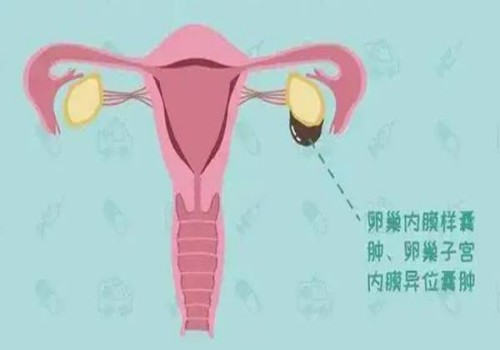 精子畸形率很难改善吗？常用的治疗方法有这几种